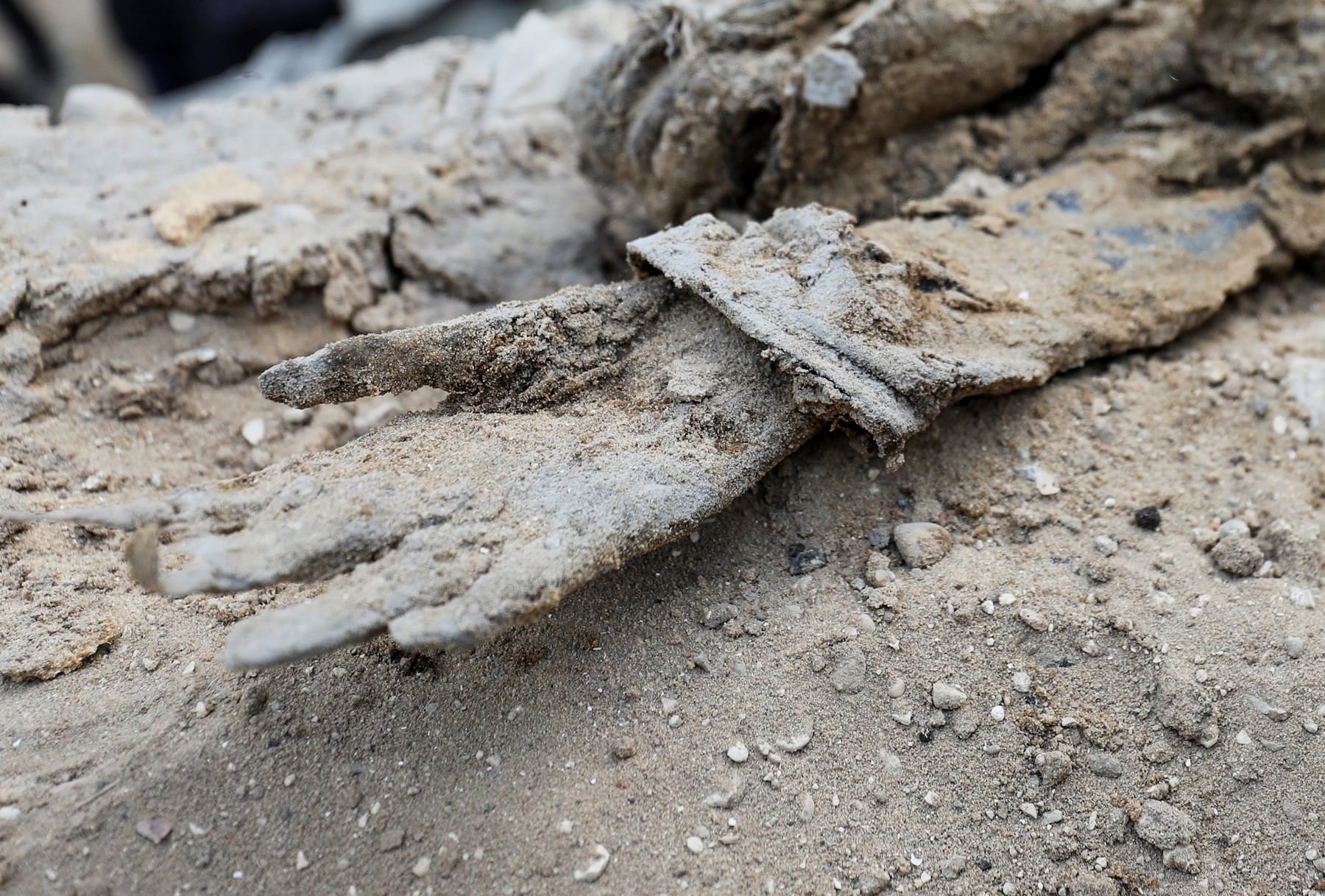 decomposed body hand found around Al-shifa complex