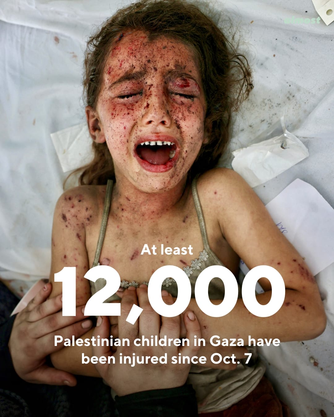 gaza 12000 children injured