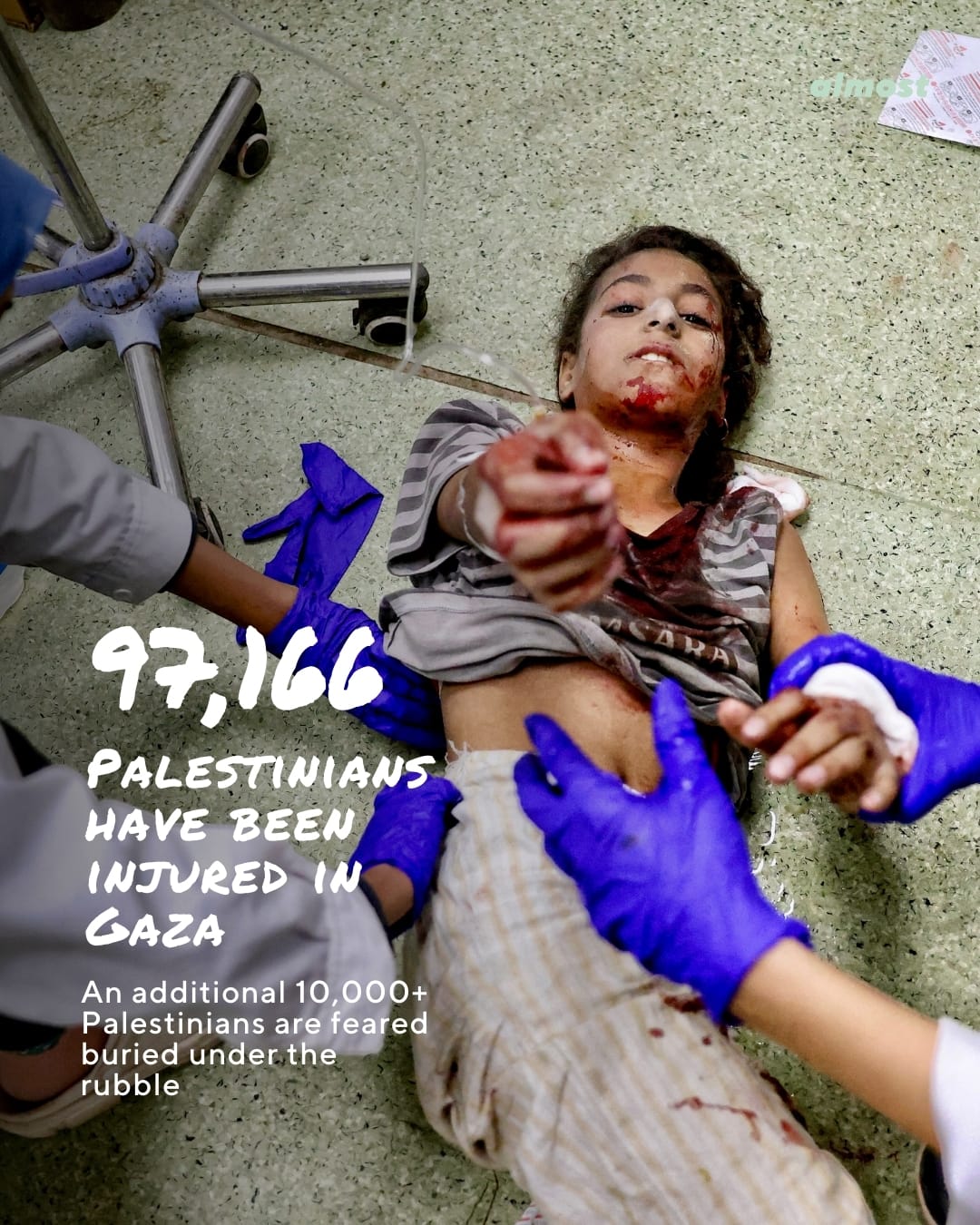 gaza genocide one year injured