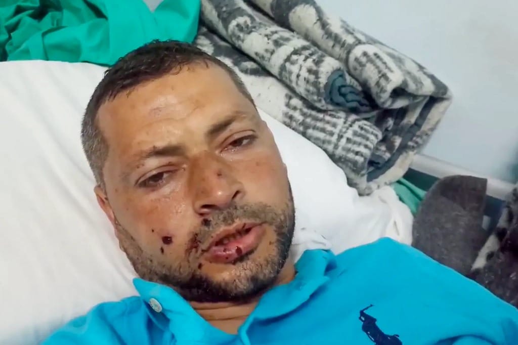 ismail Abu Omar al jazeera journalist gaza injured israel