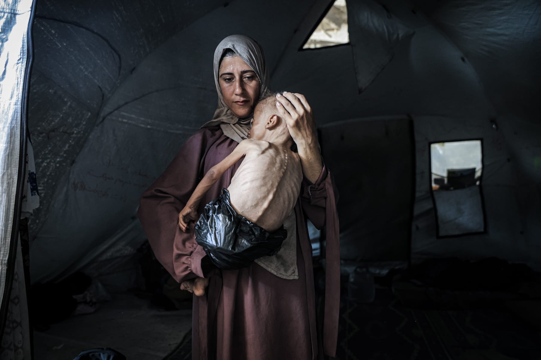 gaza famine mom child malnutrition israel blockade genocide