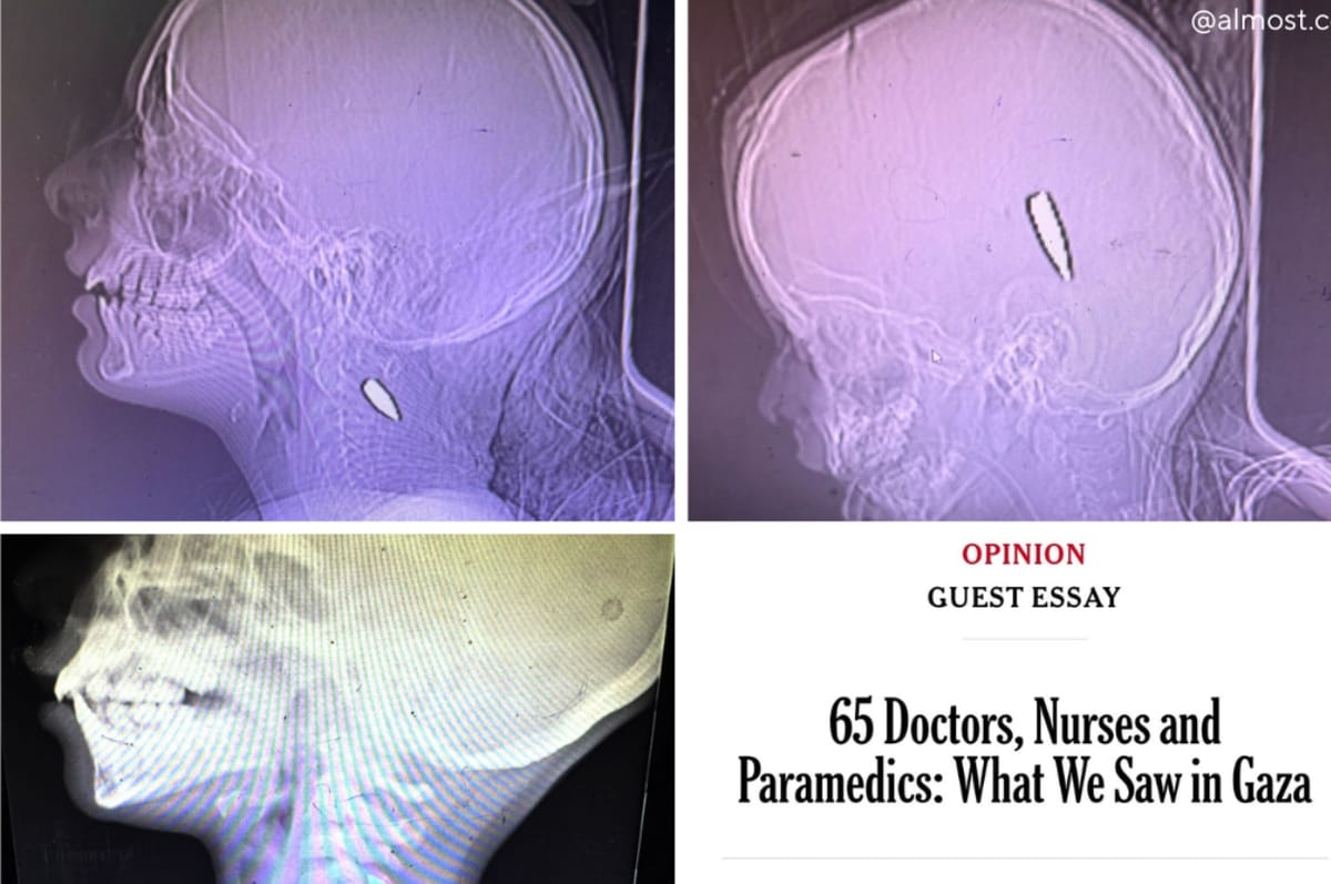 Doctors And Paramedics Who Worked In Gaza Said They Saw Children Shot In The Head Or Chest Nearly Every Day