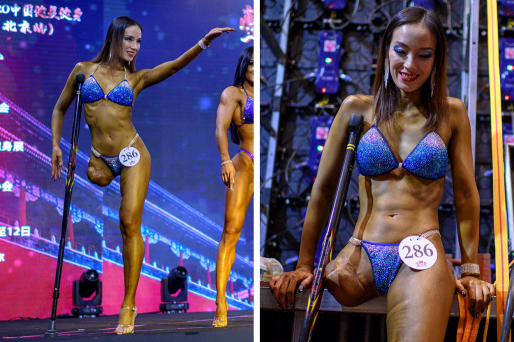 This Chinese Woman With One Leg Won A Bodybuilding Competition And People Are Loving It