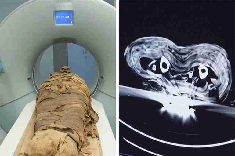 An Italian Hospital Performed A CT Scan On An Egyptian Mummy To Discover Its True Identity