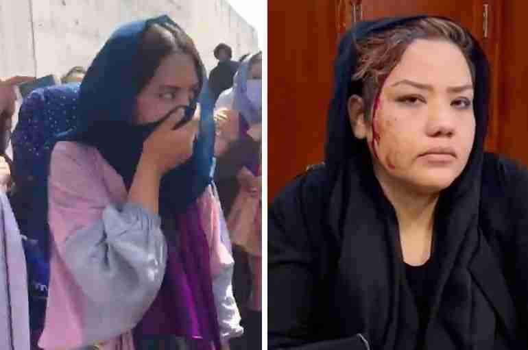 Afghan Women Protesting For Their Rights Were Attacked By The Taliban With Rifle Butts, Tear Gas And Clubs