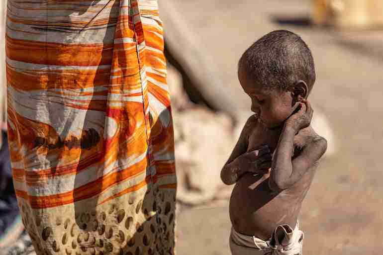 madagascar famine climate change child malnutrition