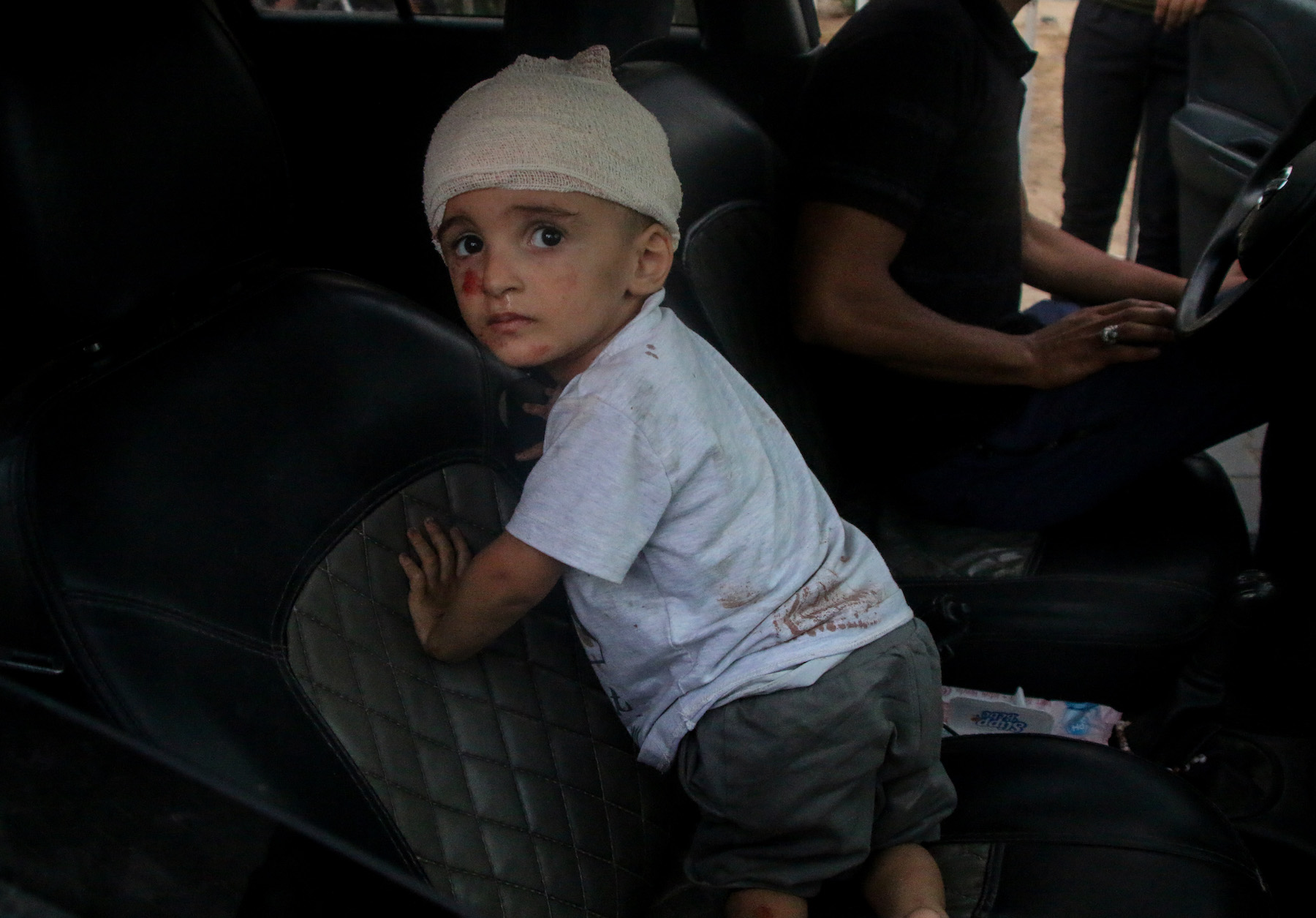 israel gaza airstrikes children injured